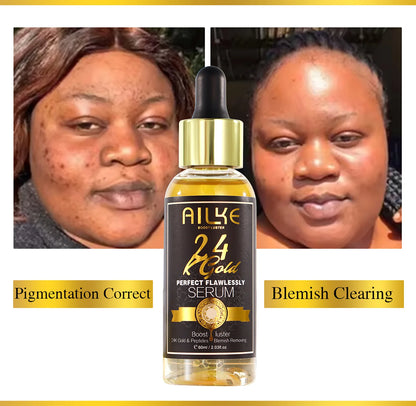 AILKE 24K Glod Flawlessly Skin Care Range, Skin Whitener, Reduce Dark Spots, Melanin, Wrinkles, Moisturize, For Women & Men
