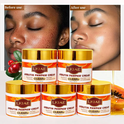 LKIAE Arbutin Pawpaw Face Cream For Women, Black Spots & Acne Correcting, Lightening Skin, Easily Absorbed, Lightweight, 80ml
